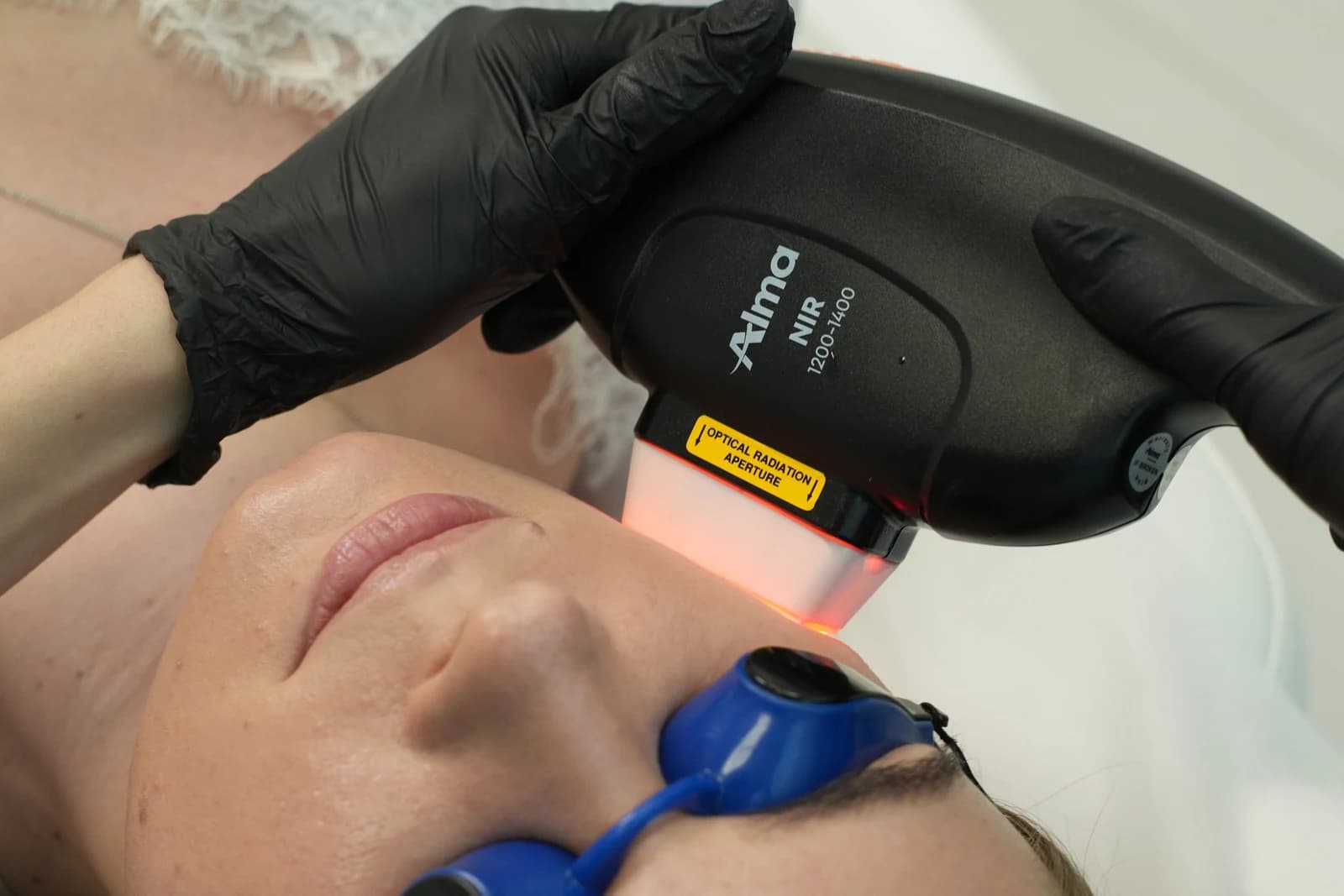 Termolifting NIR – głowica bliskiej podczerwieni na skórze twarzy pacjentki w MMClinic we Wrocławiu