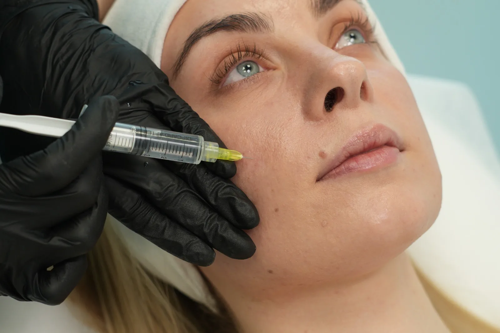 Podanie tropokolagenu cienką igłą w skórę twarzy w MMClinic we Wrocławiu