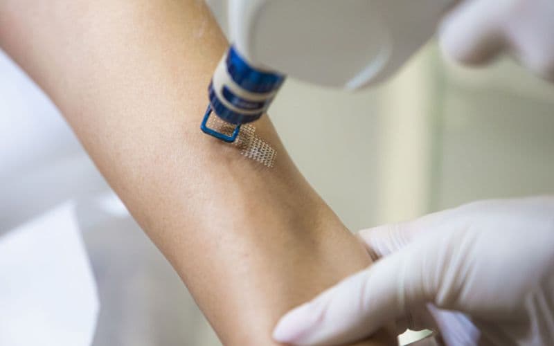 Laser-Narbenbehandlung