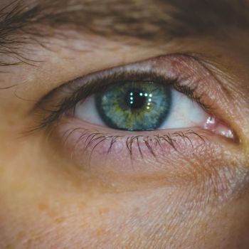 Opadająca powieka – 8 pytań i odpowiedzi