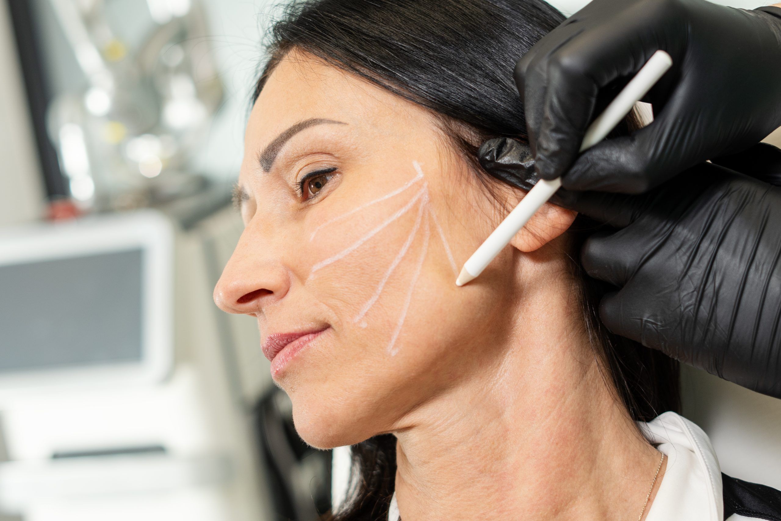 Biostymulatory tkankowe 