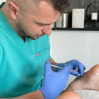 Leczenie nadpotliwości