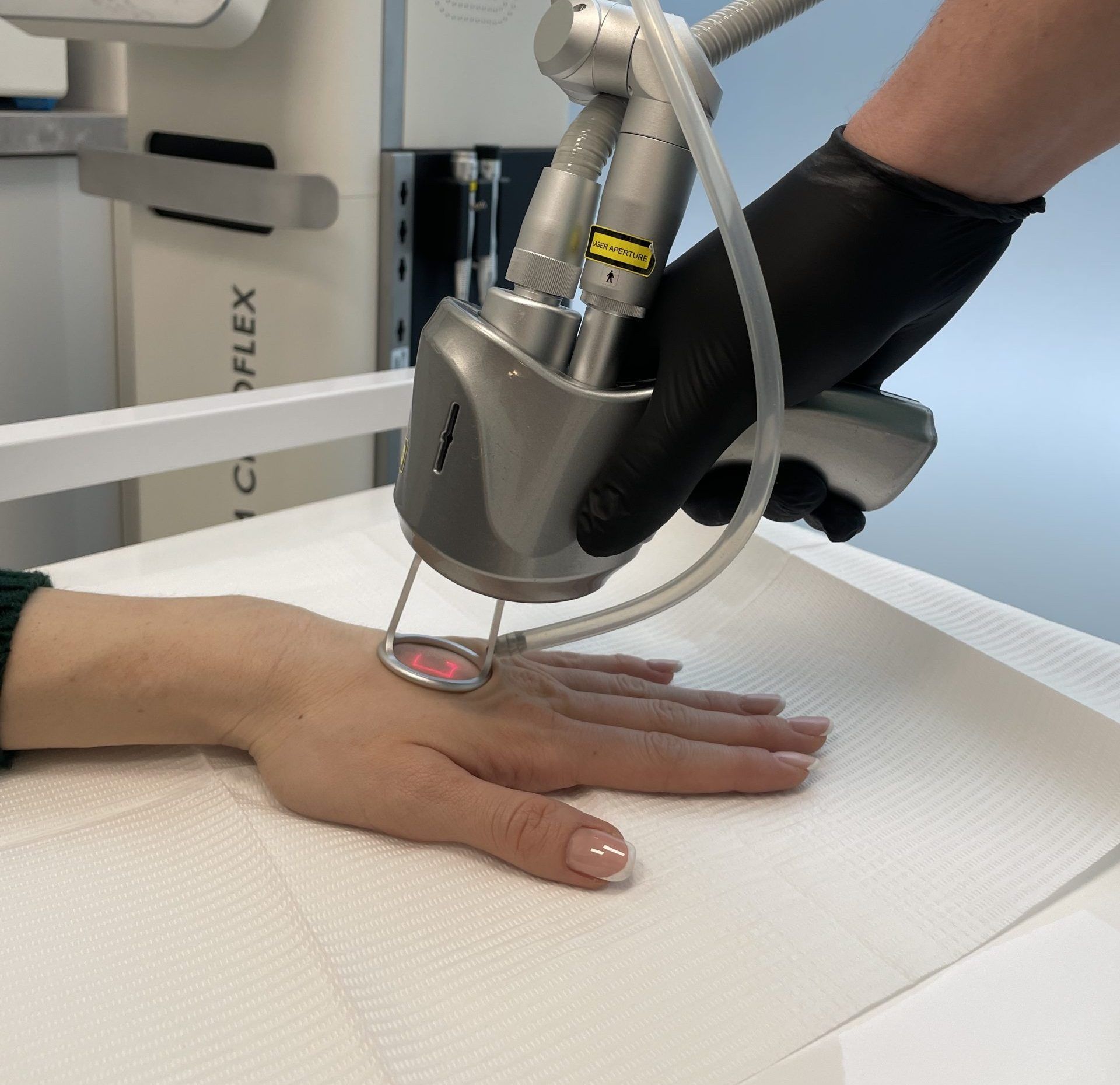 Chirurgiczne usuwanie znamion Wrocław