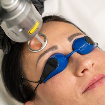 Jak dbać o wygląd twarzy? Frakcyjne odmładzanie twarzy