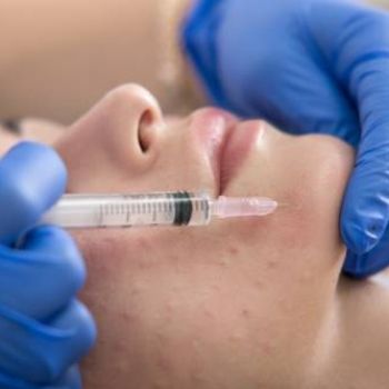 Mezoterapia igłowa a mikroigłowa
