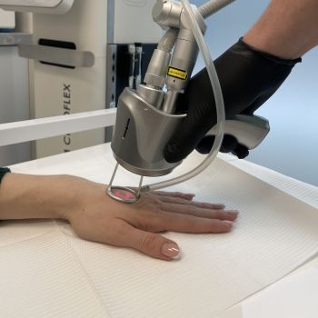 Jak zadbać o dłonie? Frakcyjne odmładzanie dłoni