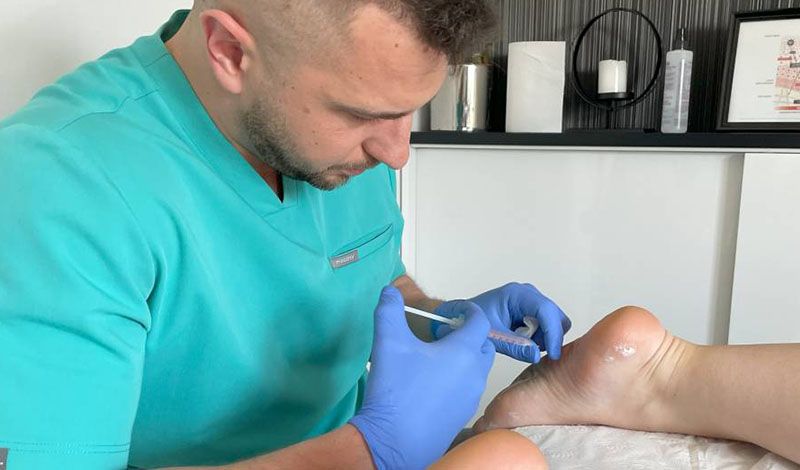 Leczenie nadpotliwości