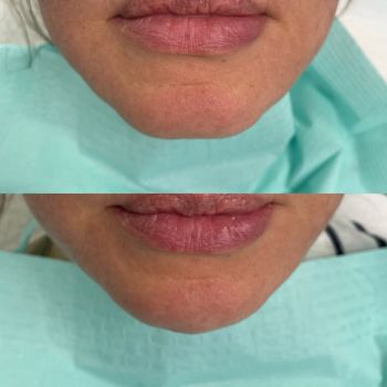 Modelowanie brody — na czym polega i dla kogo jest przeznaczone?‍‍