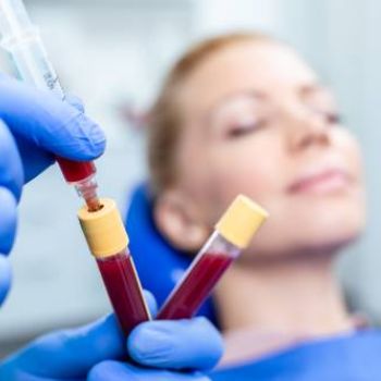 Na co pomaga osocze – jakie ma zastosowanie w medycynie estetycznej