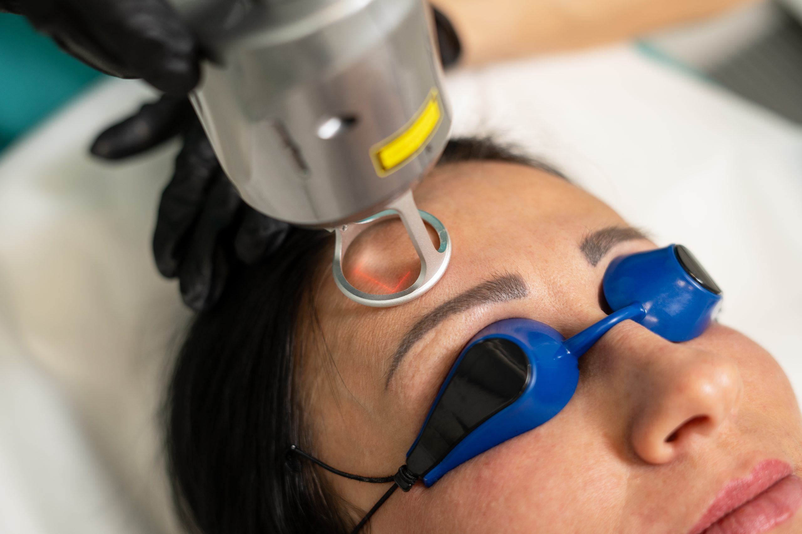 Chirurgiczne usuwanie znamion Wrocław