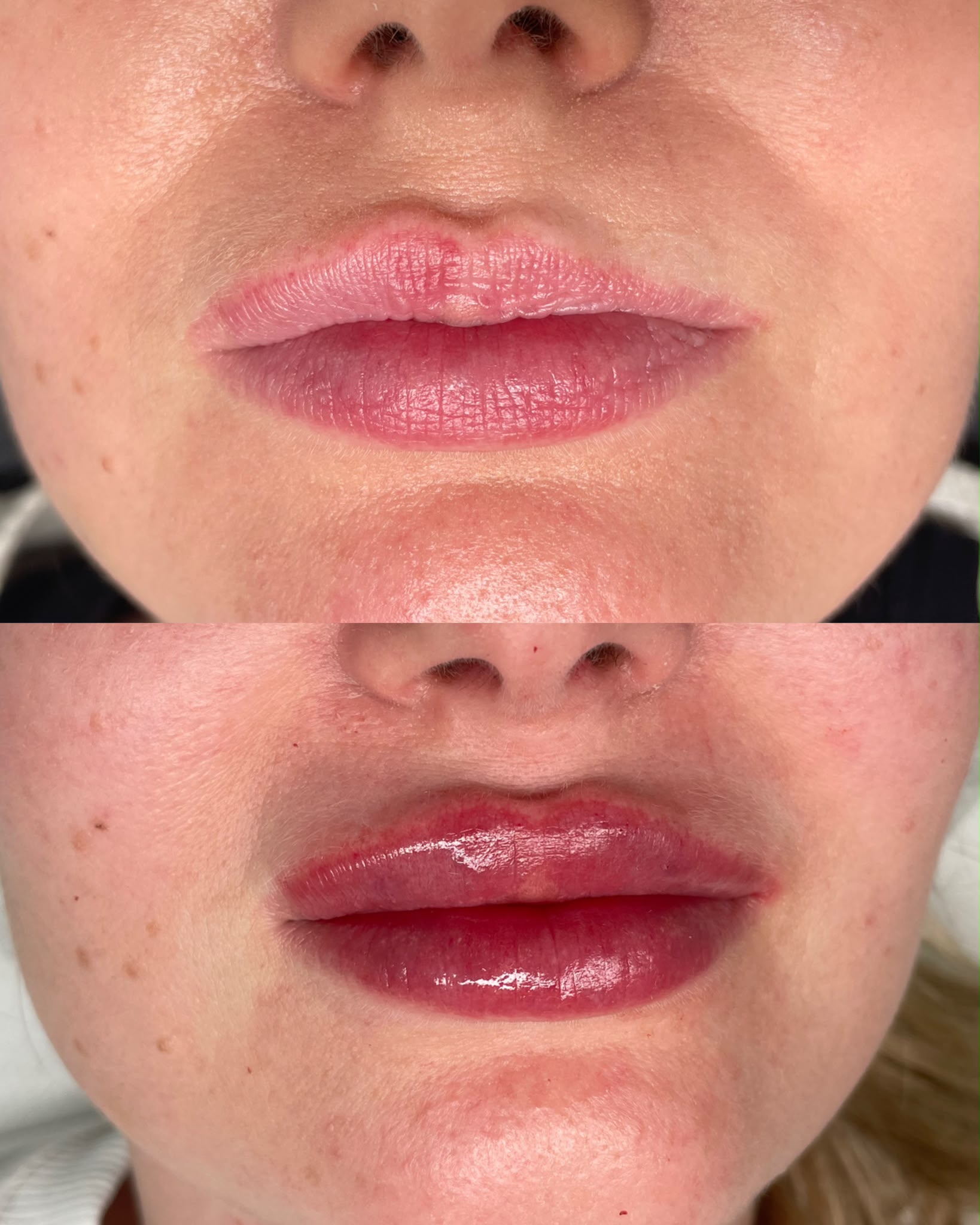 Naturalny efekt modelowania ust