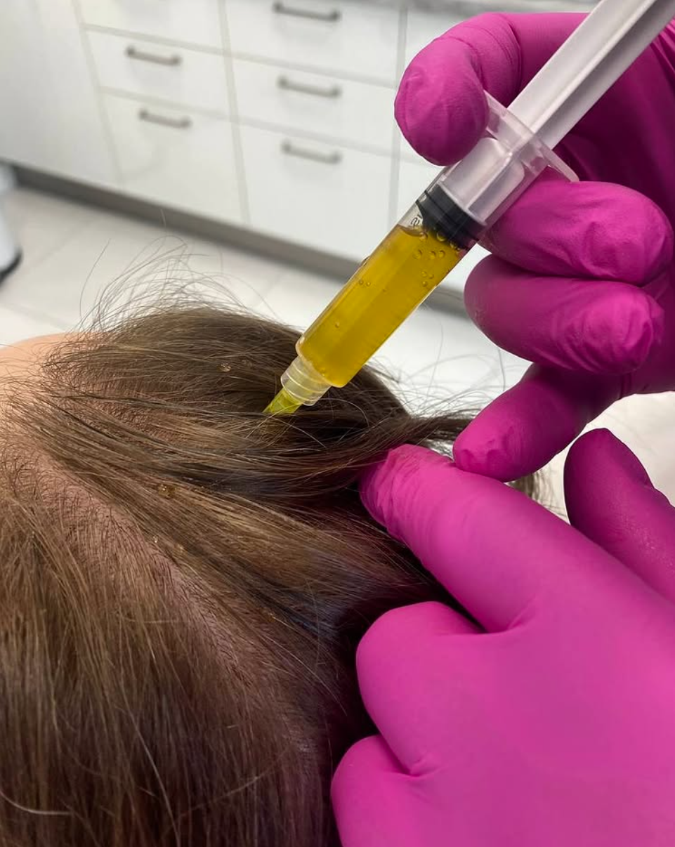 Behandlung mit plättchenreichem Plasma in Wrocław in der MM Clinic